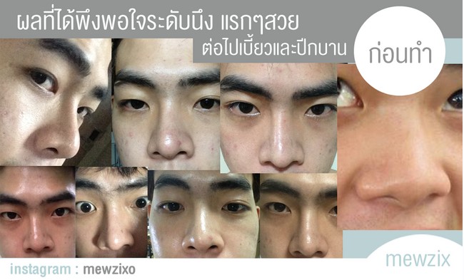 ศัลยกรรม